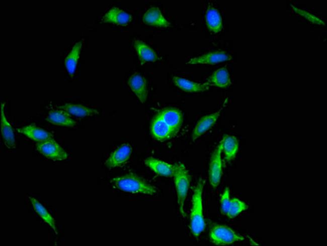 Periostin Antibody in Immunocytochemistry (ICC/IF)