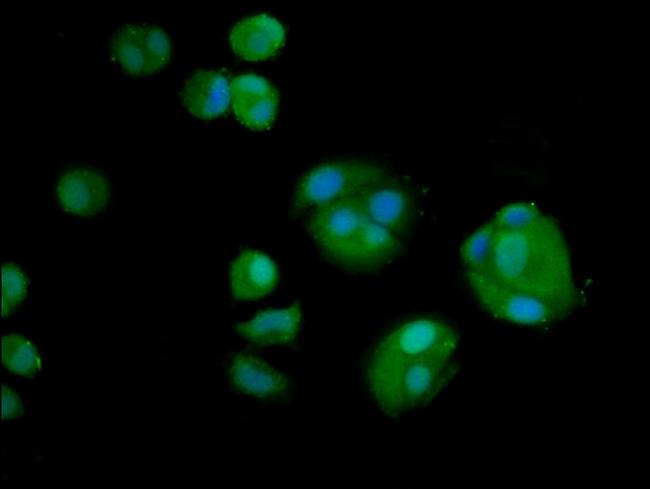 AMH Antibody in Immunocytochemistry (ICC/IF)