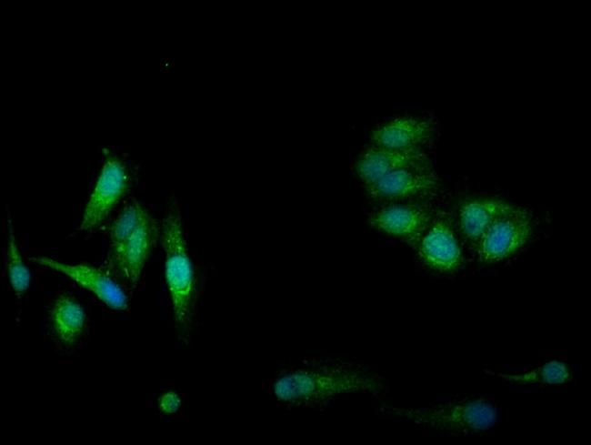 CBS Antibody in Immunocytochemistry (ICC/IF)