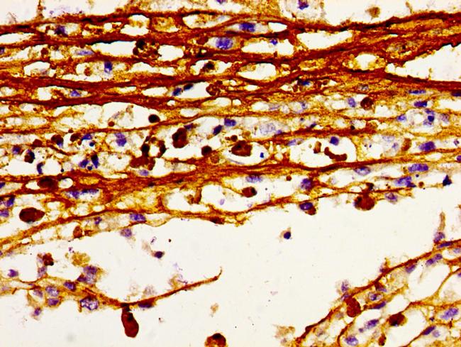 HDC Antibody in Immunohistochemistry (Paraffin) (IHC (P))