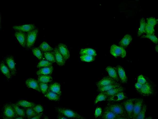 Kininogen Light Chain Antibody in Immunocytochemistry (ICC/IF)