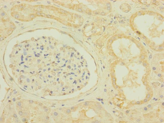 SCN7A Antibody in Immunohistochemistry (Paraffin) (IHC (P))