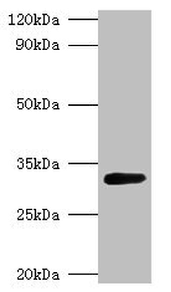 GLSA1 Antibody in Western Blot (WB)