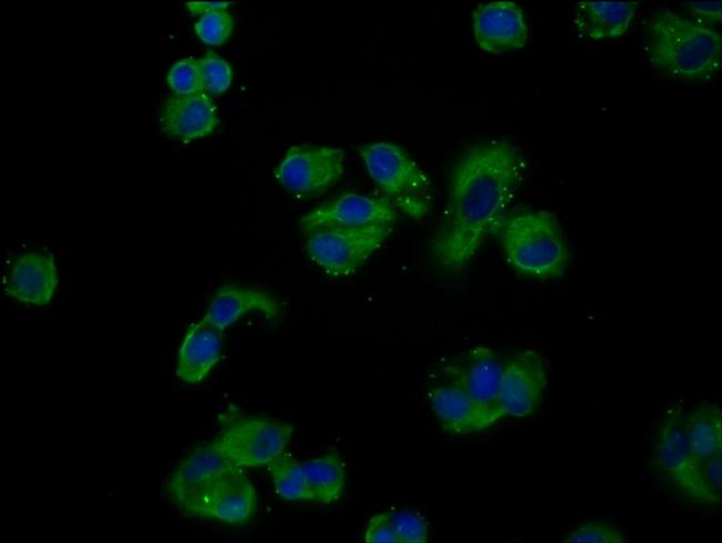 GNAS Antibody in Immunocytochemistry (ICC/IF)