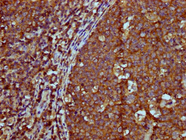 IGHM Antibody in Immunohistochemistry (Paraffin) (IHC (P))