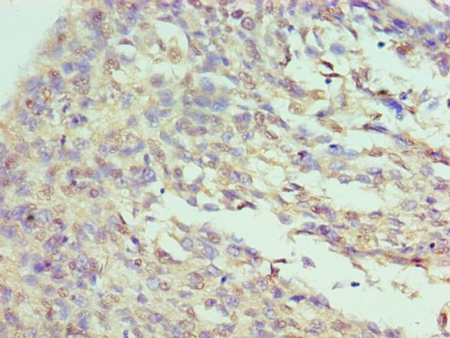 ILF3 Antibody in Immunohistochemistry (Paraffin) (IHC (P))