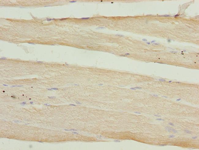 CALCOCO2 Antibody in Immunohistochemistry (Paraffin) (IHC (P))