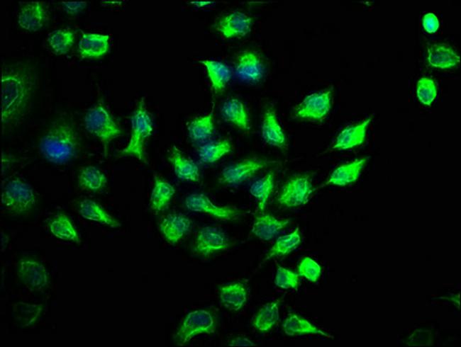 MST2 Antibody in Immunocytochemistry (ICC/IF)