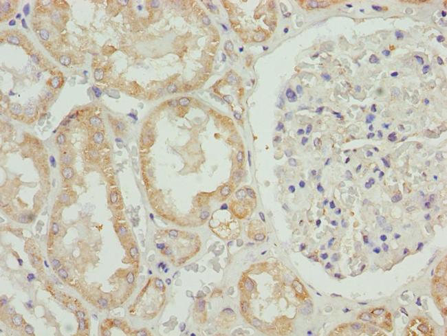 HADH Antibody in Immunohistochemistry (Paraffin) (IHC (P))