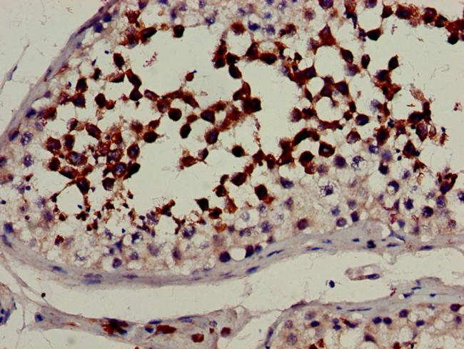 CYP51A1 Antibody in Immunohistochemistry (Paraffin) (IHC (P))