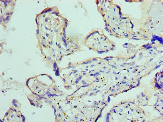 ADAM9 Antibody in Immunohistochemistry (Paraffin) (IHC (P))