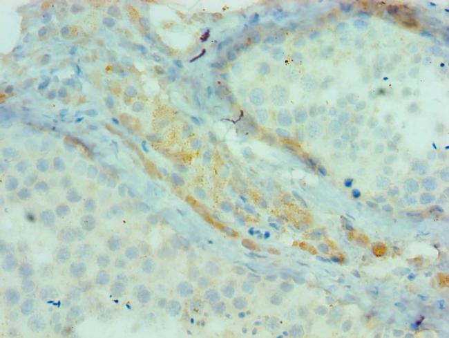 cIAP1 Antibody in Immunohistochemistry (Paraffin) (IHC (P))