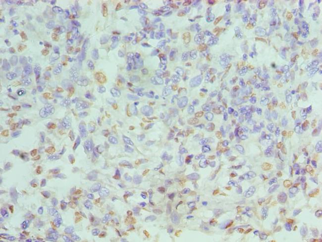 hnRNP D Antibody in Immunohistochemistry (Paraffin) (IHC (P))