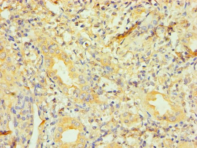 Dynactin 1 Antibody in Immunohistochemistry (Paraffin) (IHC (P))