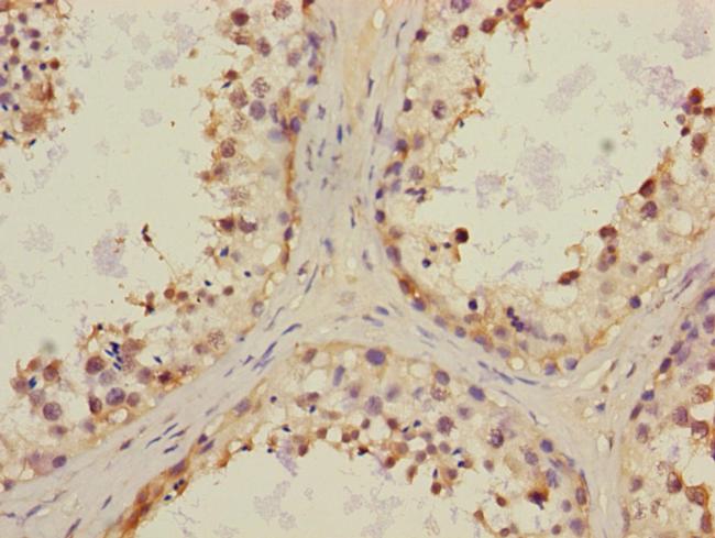 CHRNA6 Antibody in Immunohistochemistry (Paraffin) (IHC (P))