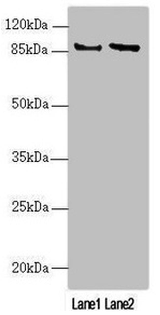 JIP2 Antibody in Western Blot (WB)