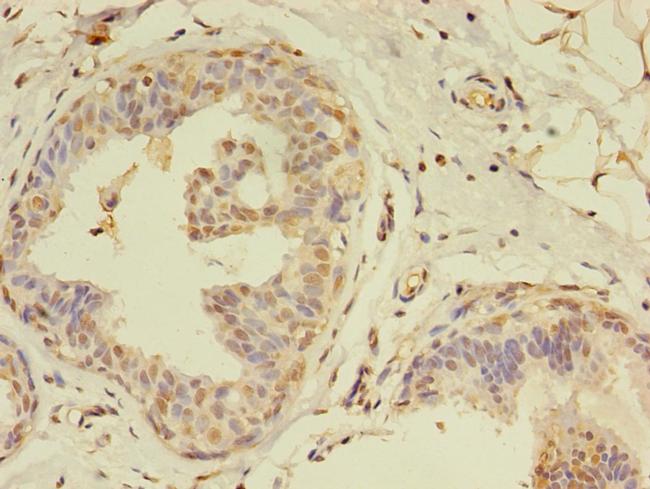 Melan-A Antibody in Immunohistochemistry (Paraffin) (IHC (P))