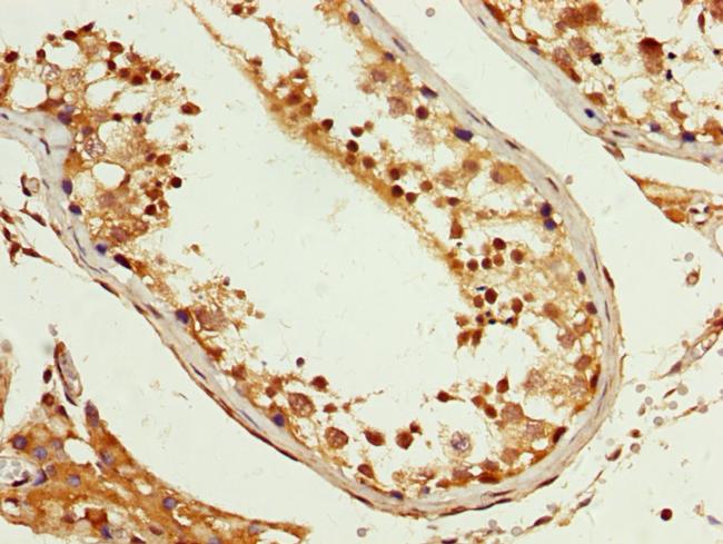 PCBP2 Antibody in Immunohistochemistry (Paraffin) (IHC (P))