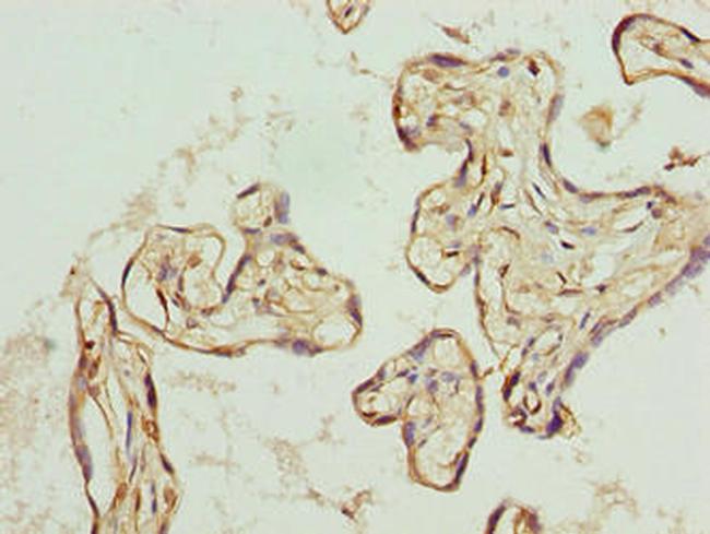 TRIP13 Antibody in Immunohistochemistry (Paraffin) (IHC (P))