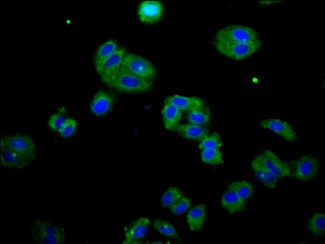 DOK7 Antibody in Immunocytochemistry (ICC/IF)