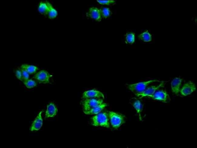 LRP8 Antibody in Immunocytochemistry (ICC/IF)