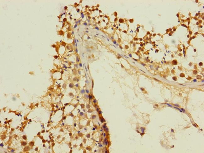 KIZUNA Antibody in Immunohistochemistry (Paraffin) (IHC (P))