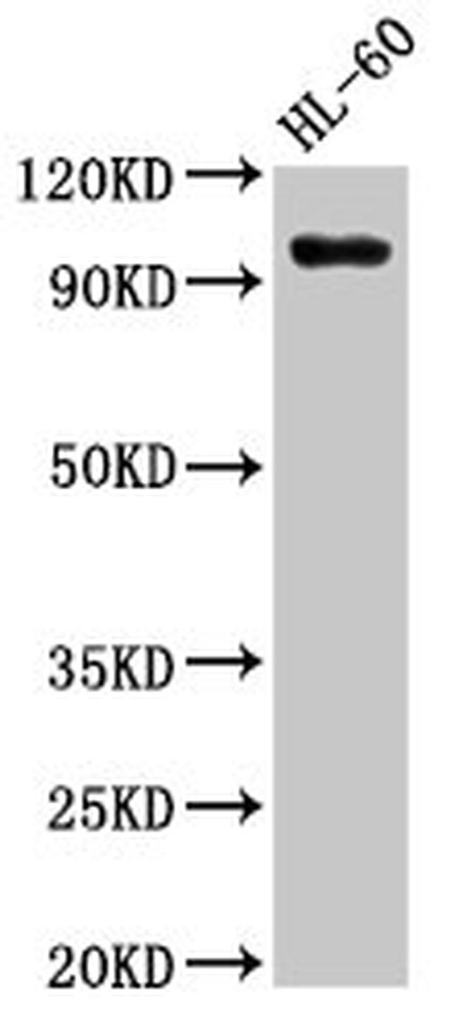 SUV420H1 Antibody in Western Blot (WB)