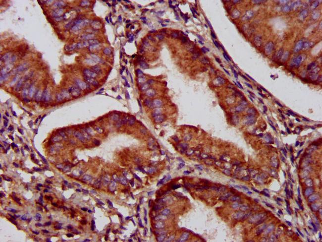 C5orf33 Antibody in Immunohistochemistry (Paraffin) (IHC (P))