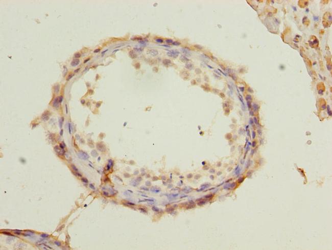 RUNDC3A Antibody in Immunohistochemistry (Paraffin) (IHC (P))