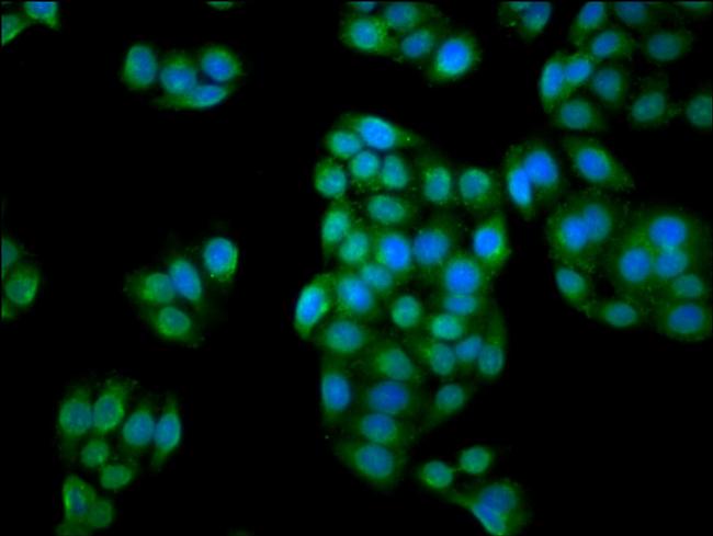 C1orf69 Antibody in Immunocytochemistry (ICC/IF)