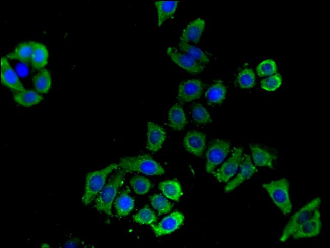 SLC16A9 Antibody in Immunocytochemistry (ICC/IF)