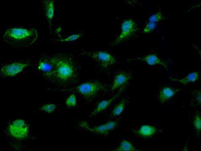 SLC25A24 Antibody in Immunocytochemistry (ICC/IF)