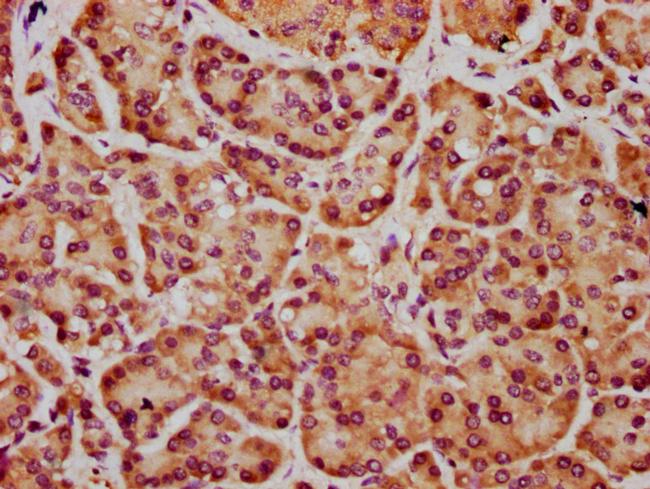 FRMD7 Antibody in Immunohistochemistry (Paraffin) (IHC (P))