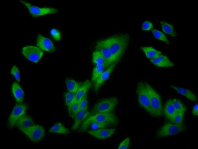 SLC16A12 Antibody in Immunocytochemistry (ICC/IF)