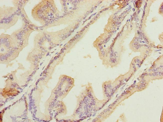 HSDL2 Antibody in Immunohistochemistry (Paraffin) (IHC (P))