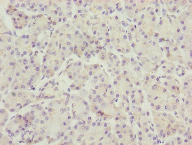 TTLL7 Antibody in Immunohistochemistry (Paraffin) (IHC (P))