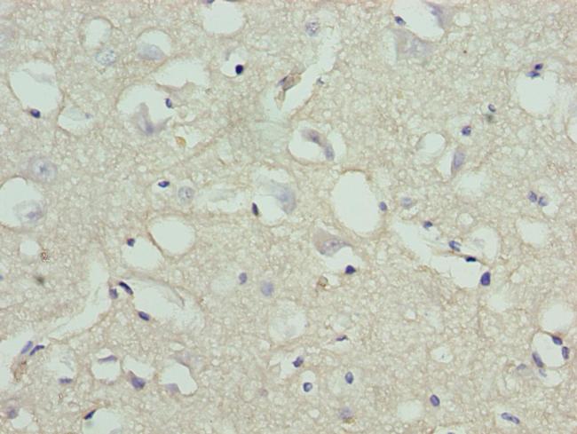 STOX1 Antibody in Immunohistochemistry (Paraffin) (IHC (P))