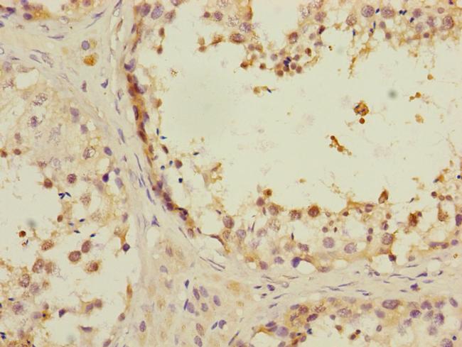 ANKS1B Antibody in Immunohistochemistry (Paraffin) (IHC (P))