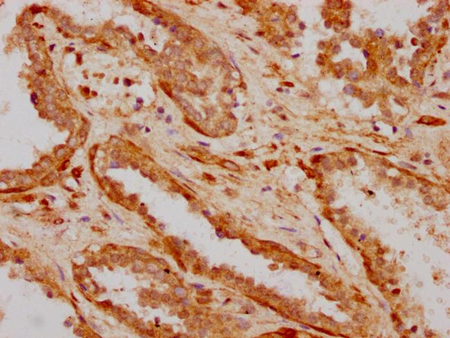 ILDR1 Antibody in Immunohistochemistry (Paraffin) (IHC (P))