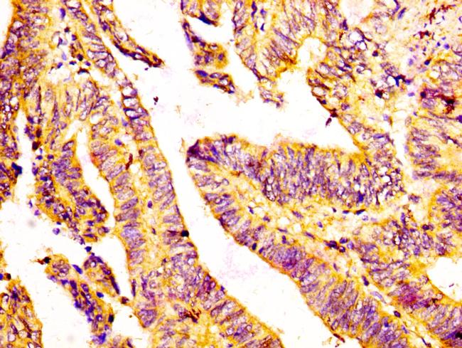 GDF7 Antibody in Immunohistochemistry (Paraffin) (IHC (P))