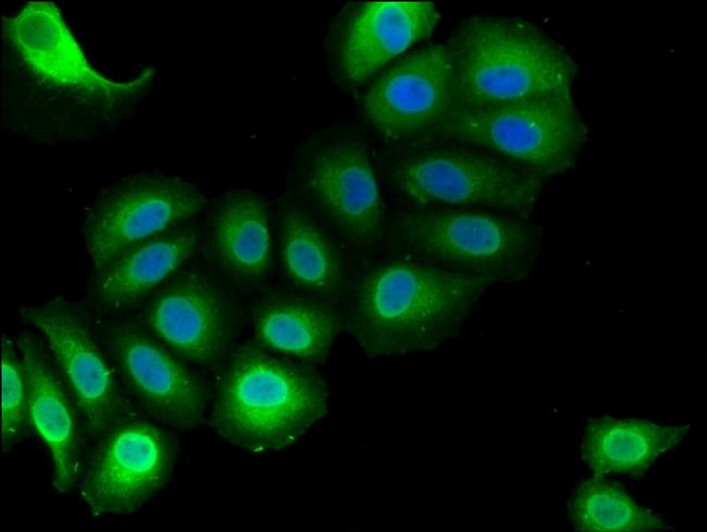 RAI1 Antibody in Immunocytochemistry (ICC/IF)