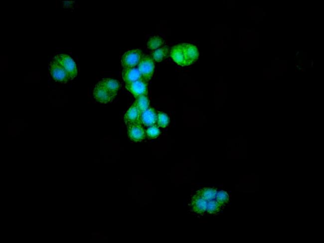 ATG4D Antibody in Immunocytochemistry (ICC/IF)