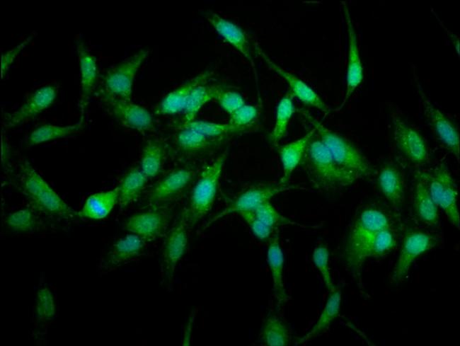 USP48 Antibody in Immunocytochemistry (ICC/IF)