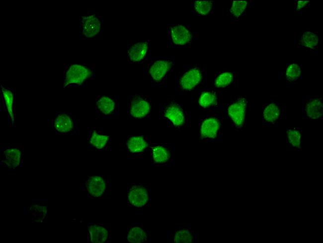 CAND1 Antibody in Immunocytochemistry (ICC/IF)