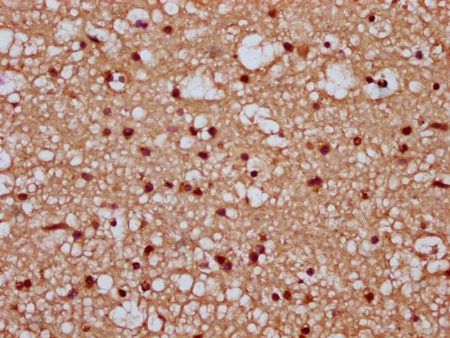 TIPARP Antibody in Immunohistochemistry (Paraffin) (IHC (P))