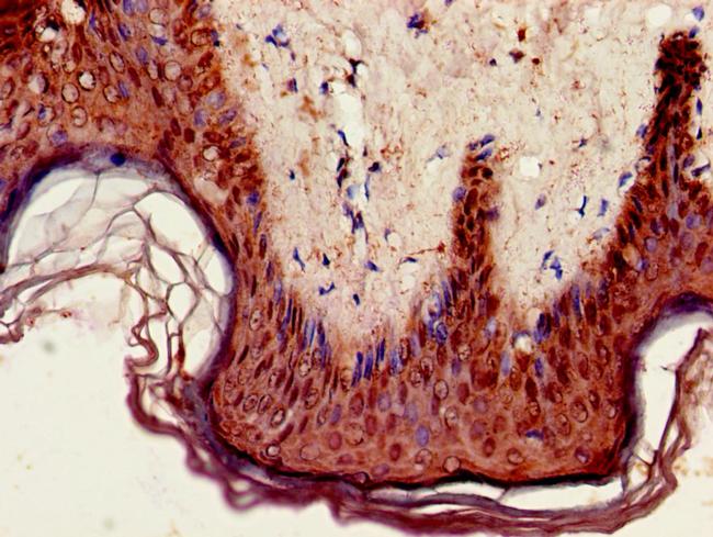 GPIHBP1 Antibody in Immunohistochemistry (Paraffin) (IHC (P))