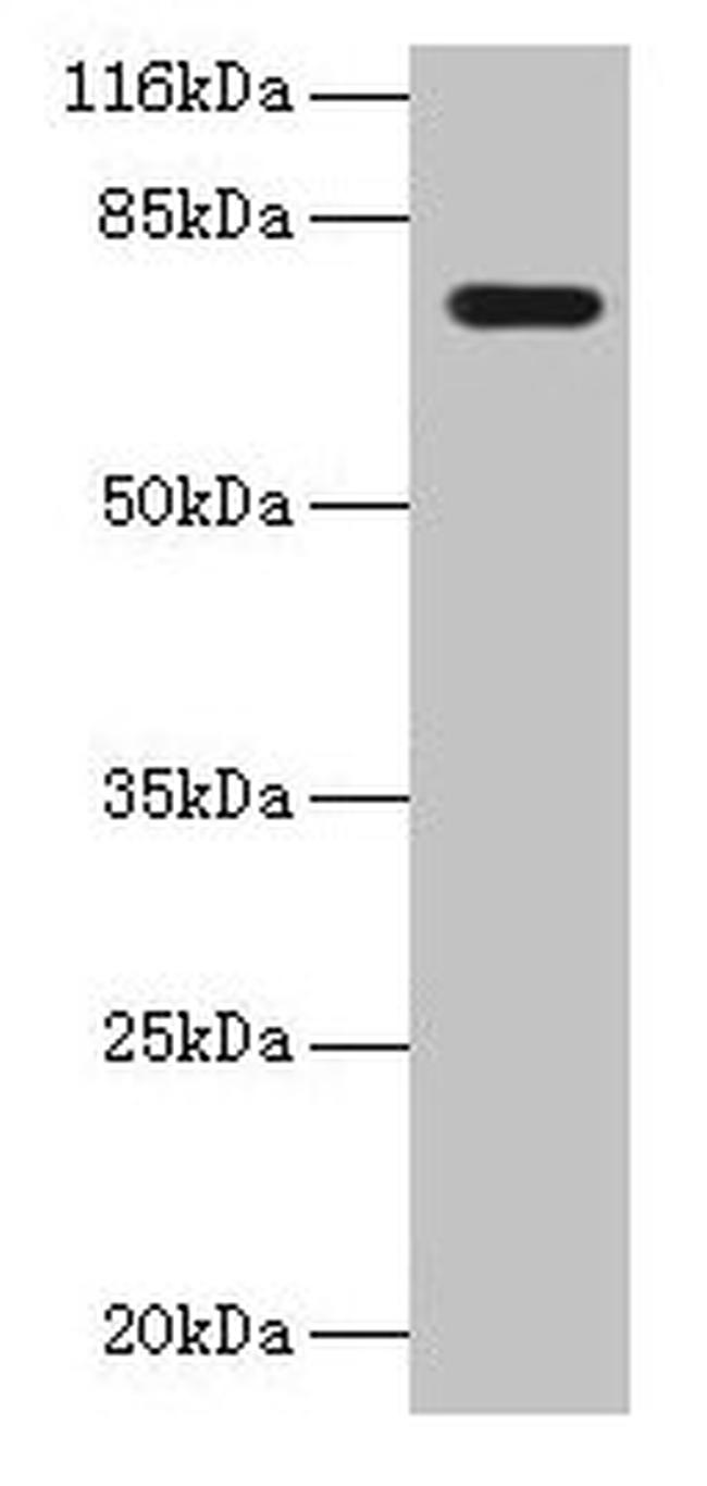 KBTBD2 Antibody in Western Blot (WB)