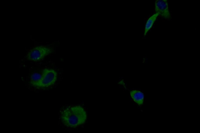 IFNLR1 Antibody in Immunocytochemistry (ICC/IF)