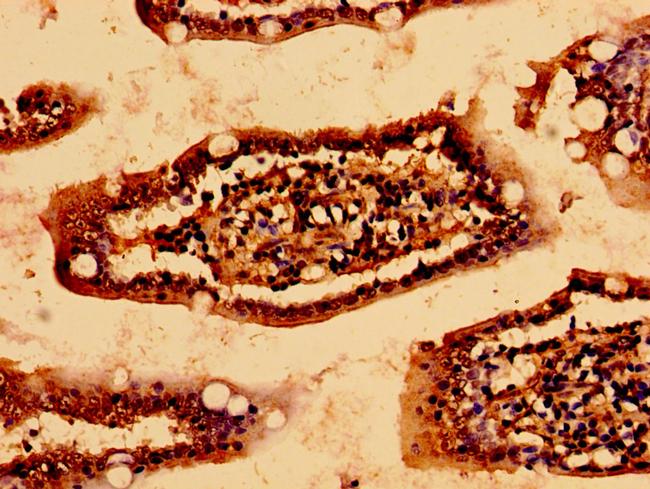 HSCB Antibody in Immunohistochemistry (Paraffin) (IHC (P))