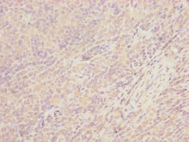 CEP57L1 Antibody in Immunohistochemistry (Paraffin) (IHC (P))